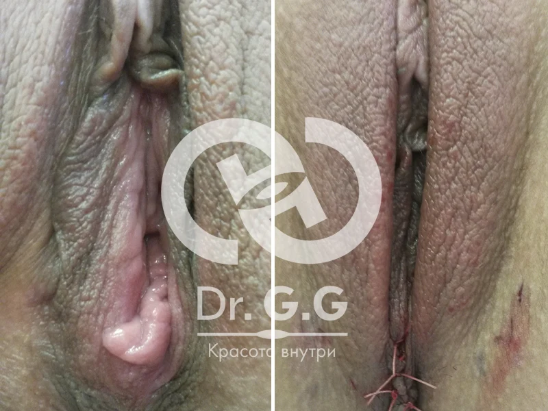 Доктор Григорьевская Лариса Анатольевна